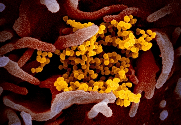 신종 코로나바이러스 전자현미경 이미지. [연합]