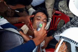 미얀마 남부도시 다웨이에서 반쿠데타 시위에 참여했다가 다쳐서 의료진의 치료를 받는 시민.[연합]